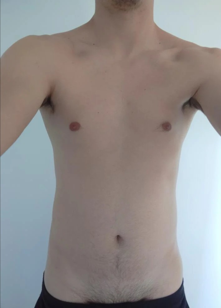 Perfil de Antero